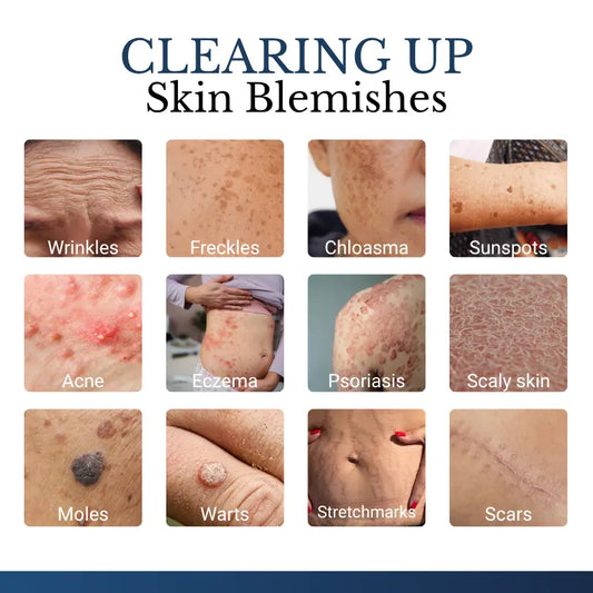DermaVelle™ | 2-in-1 Mikronadel-Pflaster | Für sichtbar glattere Haut & weniger Hautanhängsel